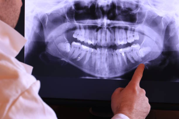 Best Emergency Dental Care for Sports Injuries in Alderwood Manor, WA